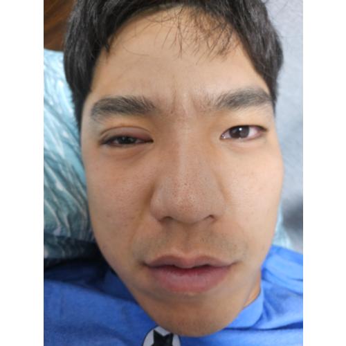 허정우